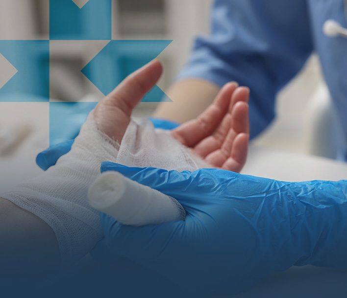 Burn Injuries